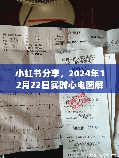 小红书分享，掌握脉搏健康秘籍——实时心电图解读（日期标注）